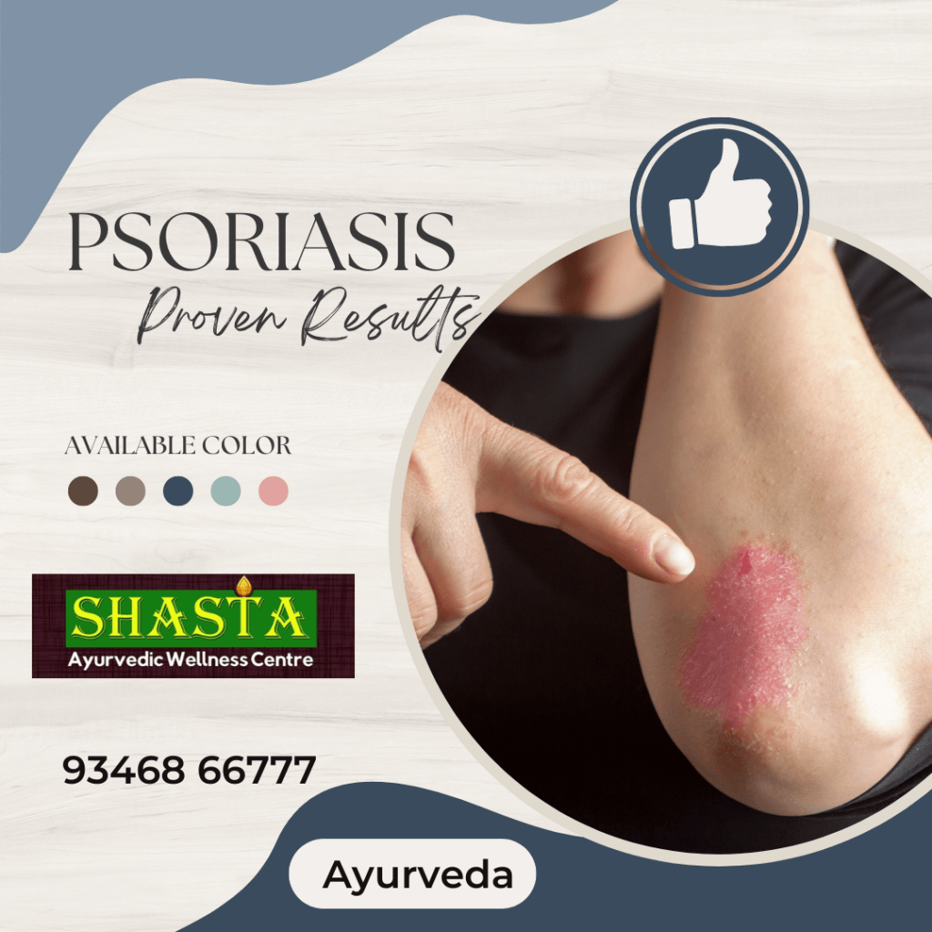 Psoriasis Traditional Ayurvedic Hospital in Vijayawada Shasta