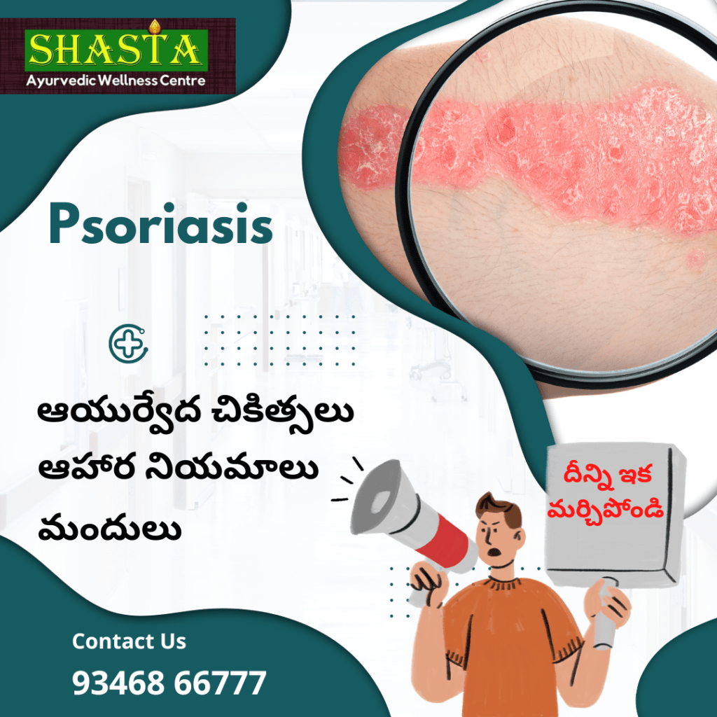 Psoriasis treatments at Shasta Traditional Ayurvedic Hospital in