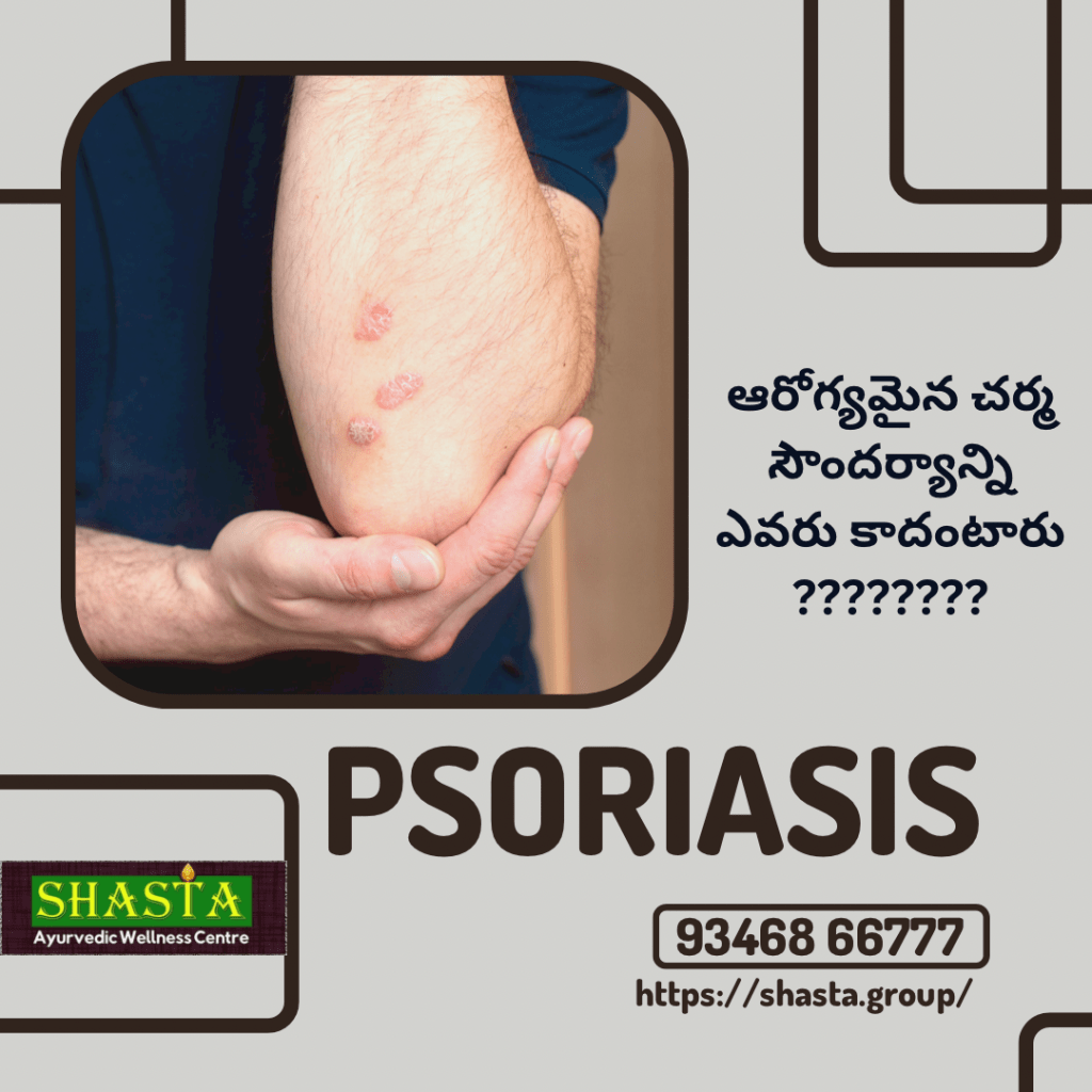Psoriasis Traditional Ayurvedic Hospital in Vijayawada Shasta
