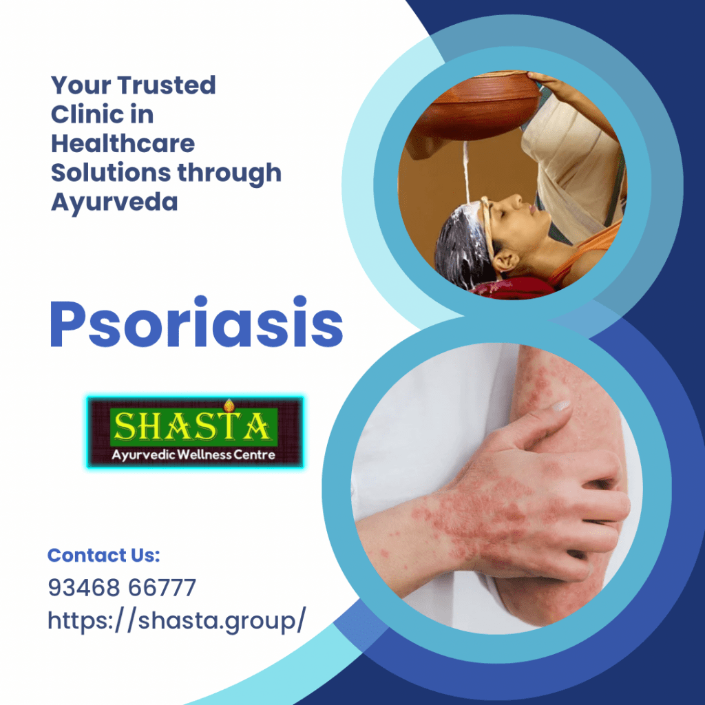 Psoriasis Traditional Ayurvedic Hospital in Vijayawada Shasta
