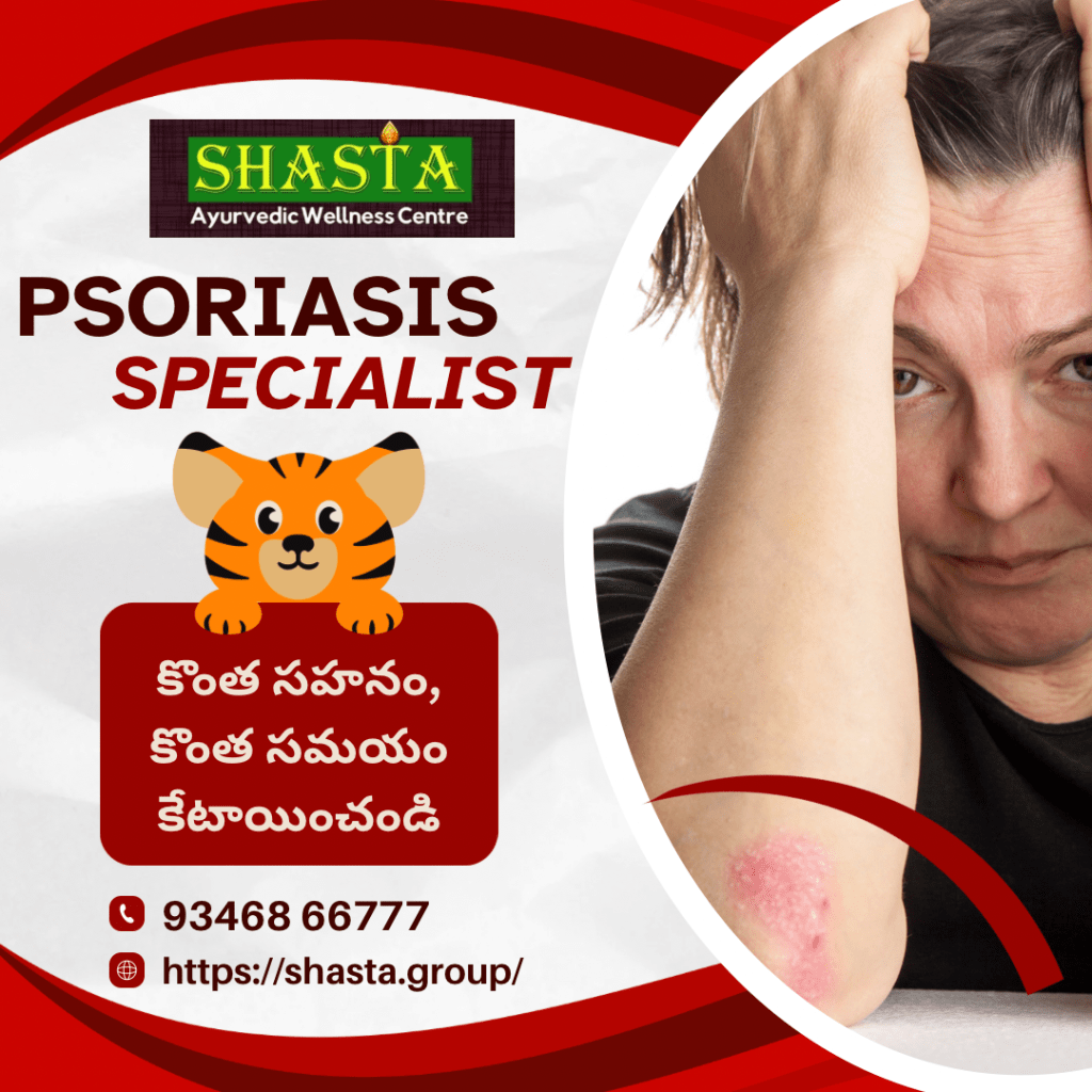 Psoriasis Traditional Ayurvedic Hospital in Vijayawada Shasta